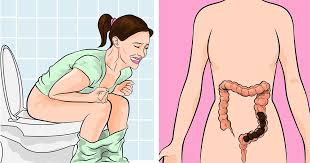 Root Causes of Constipation and How to Fix Constipation Naturally- a Functional Medicine Deep Dive